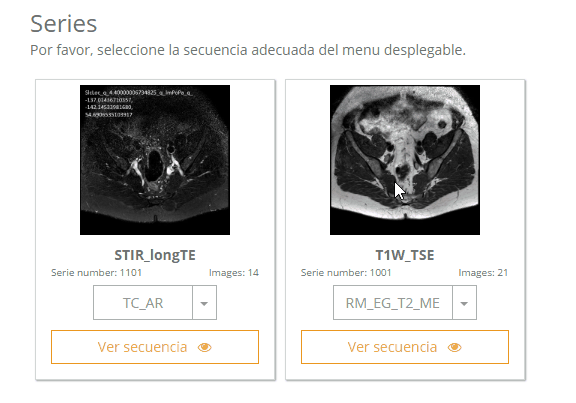 ScrollThumbnails_focus