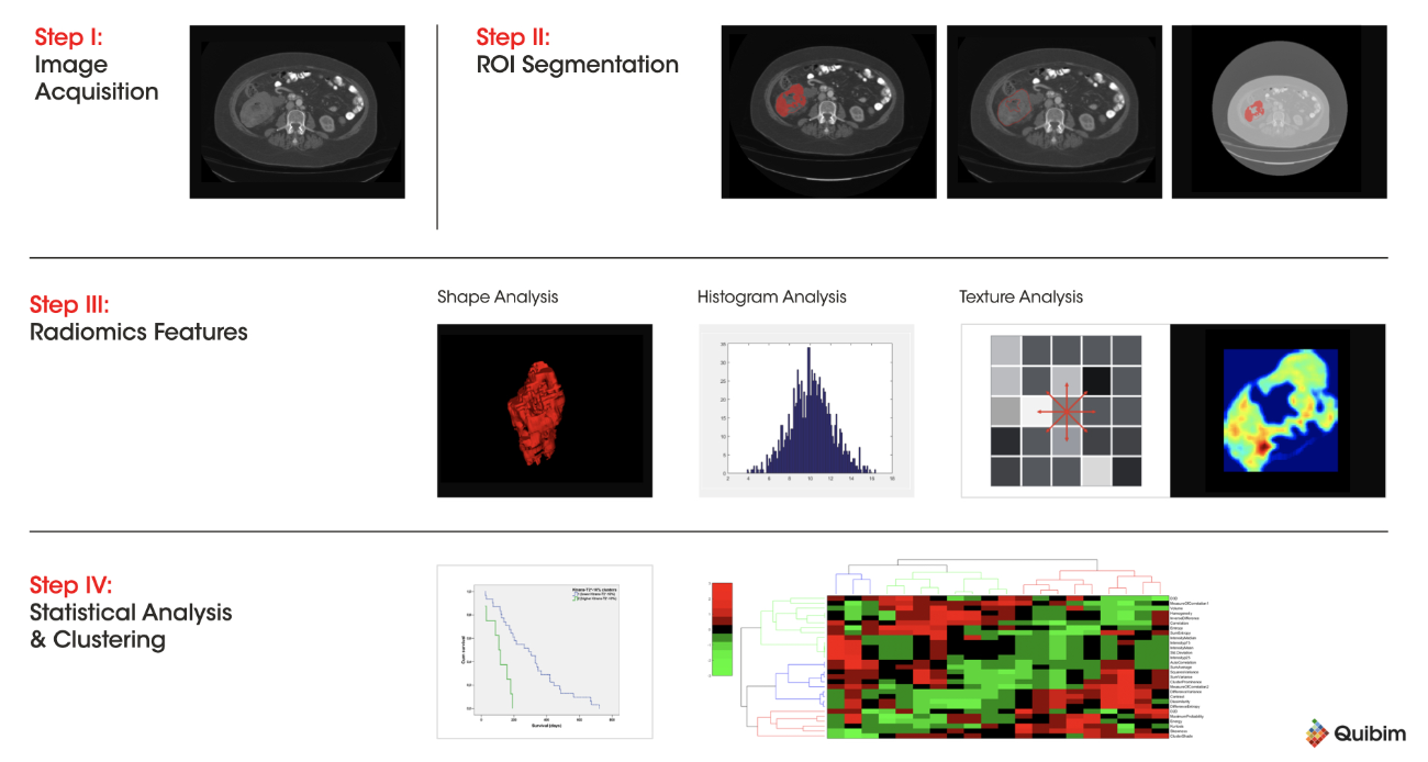 Development of a radiomics model 