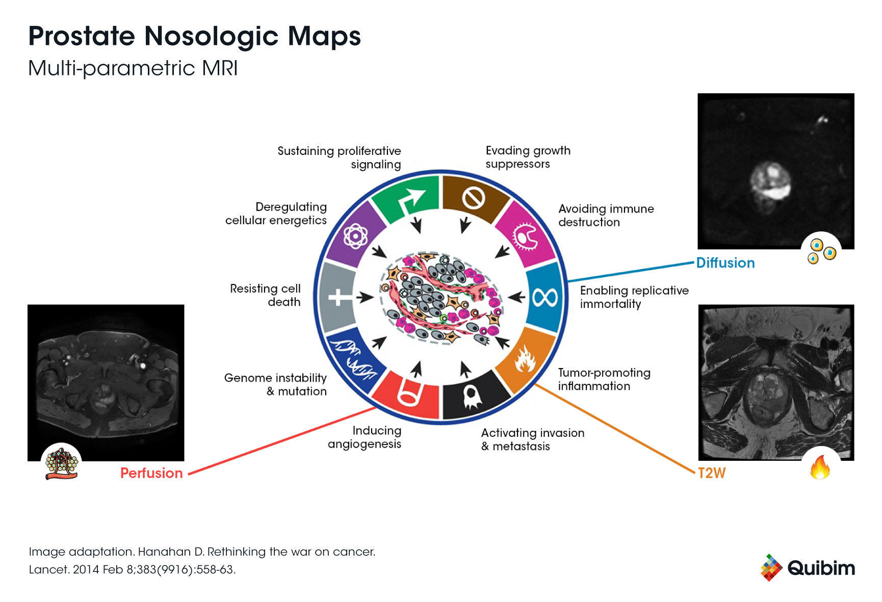 Prostate Nosologic Maps