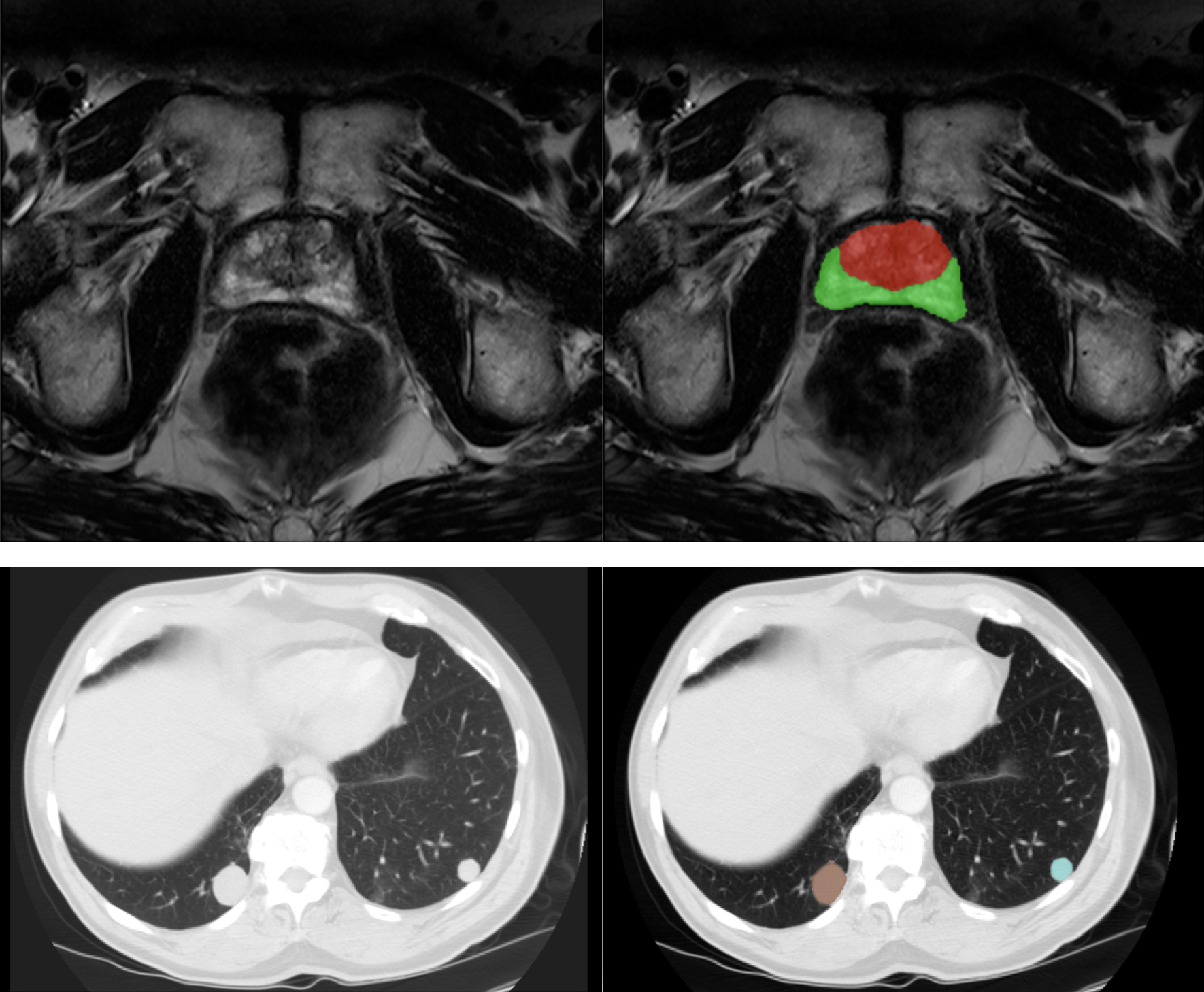 AI in radiology Figure 2