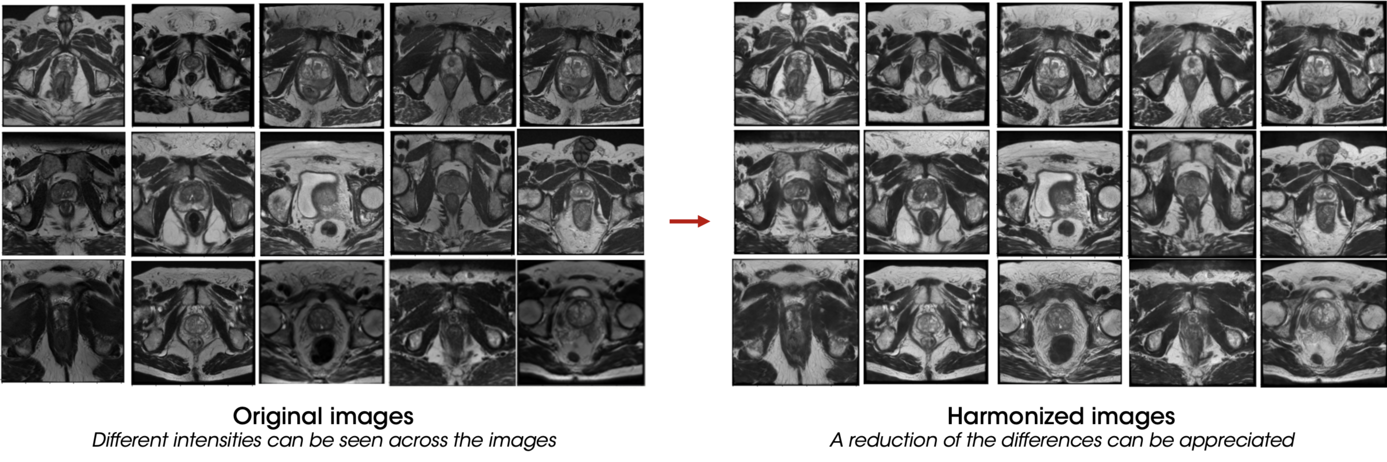 Benefits of AI in radiology