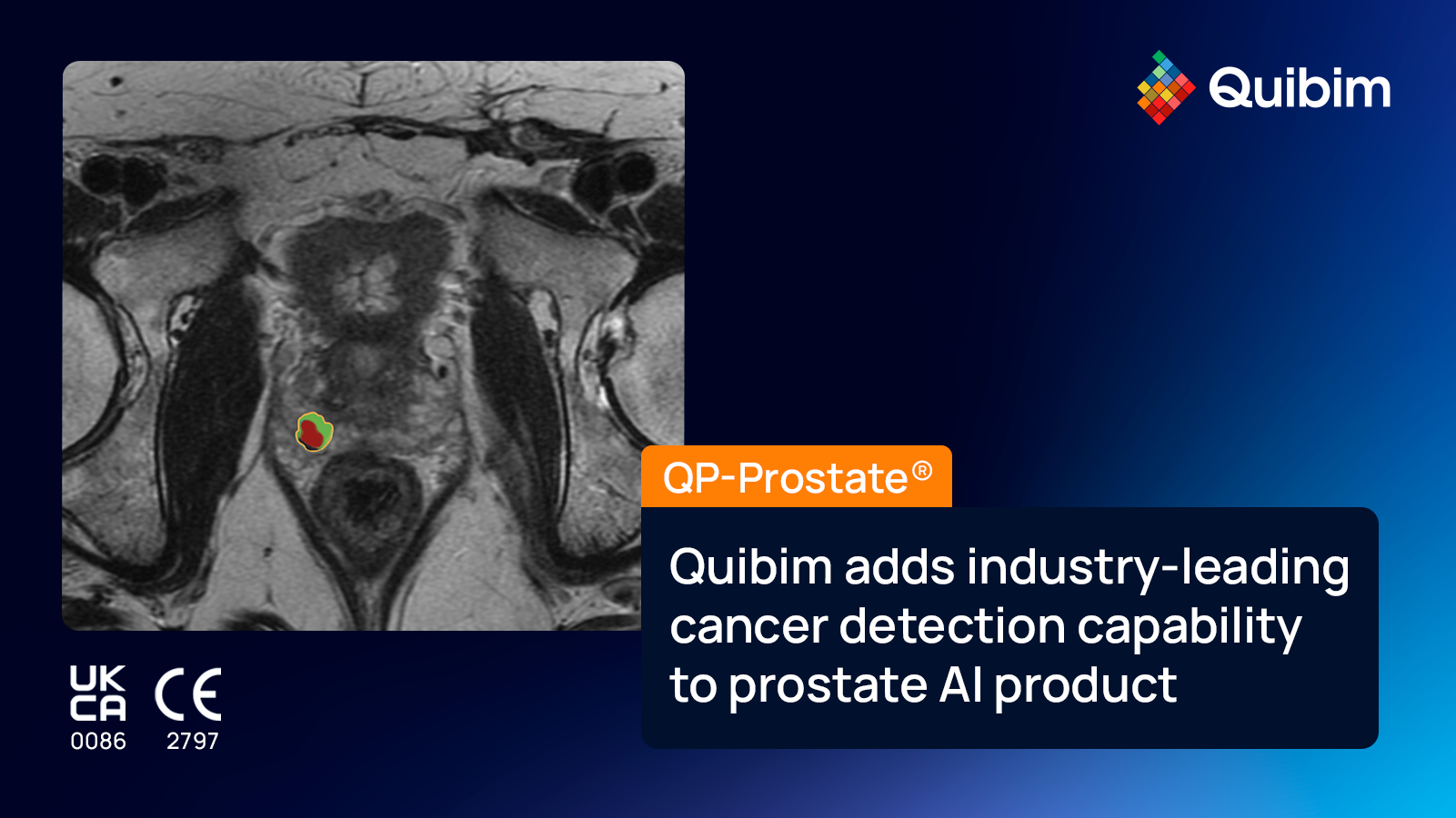 QP-Prostate lesion detection red