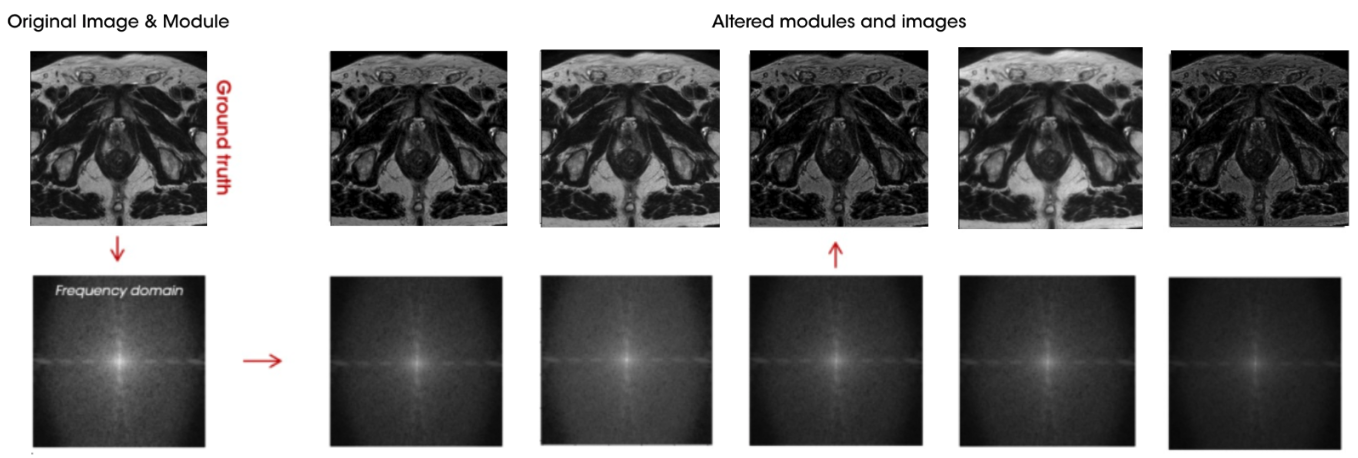 MRI image harmonization