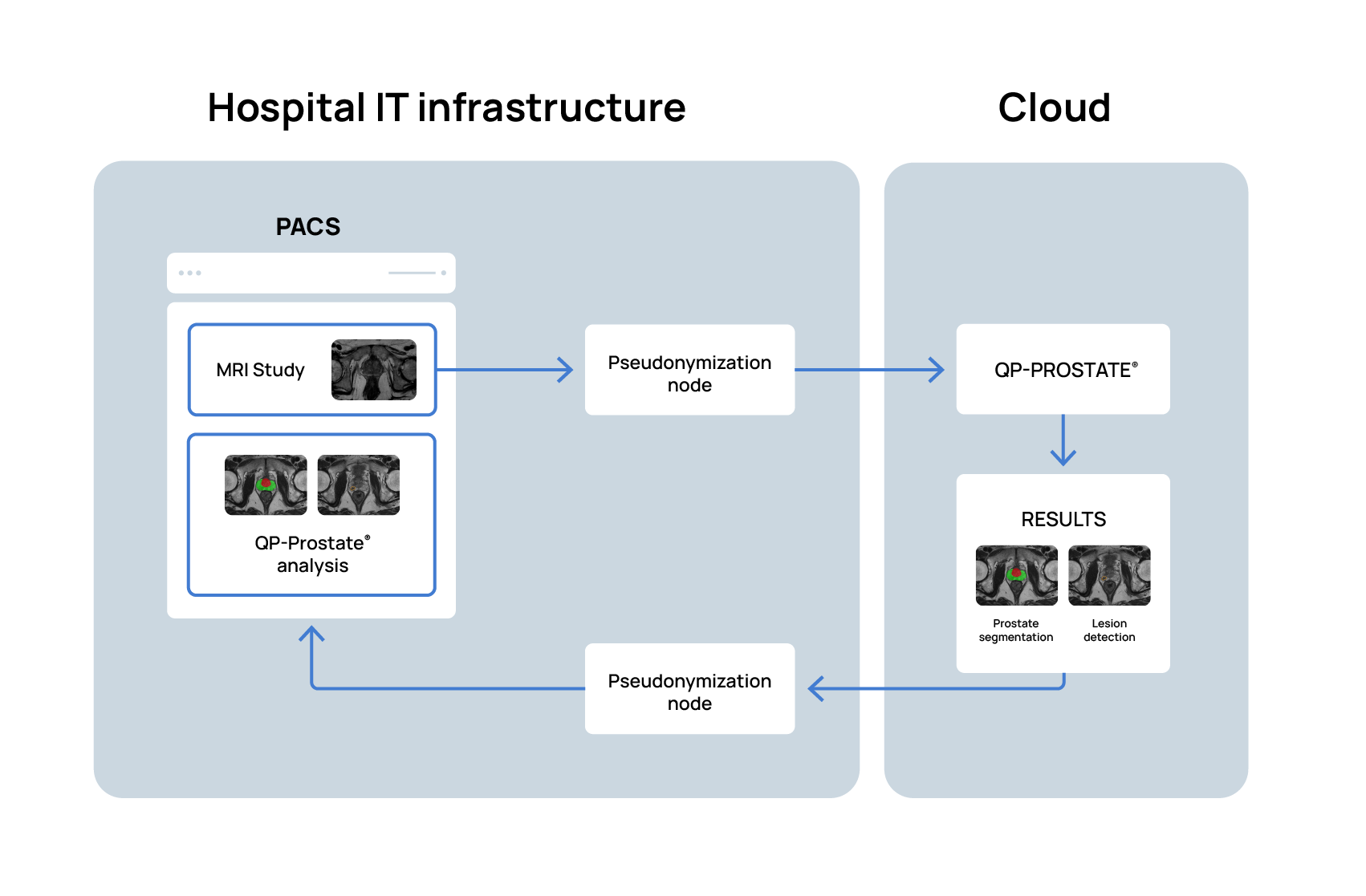 AI-powered lesion detection in prostate cancer: a paradigm shift 