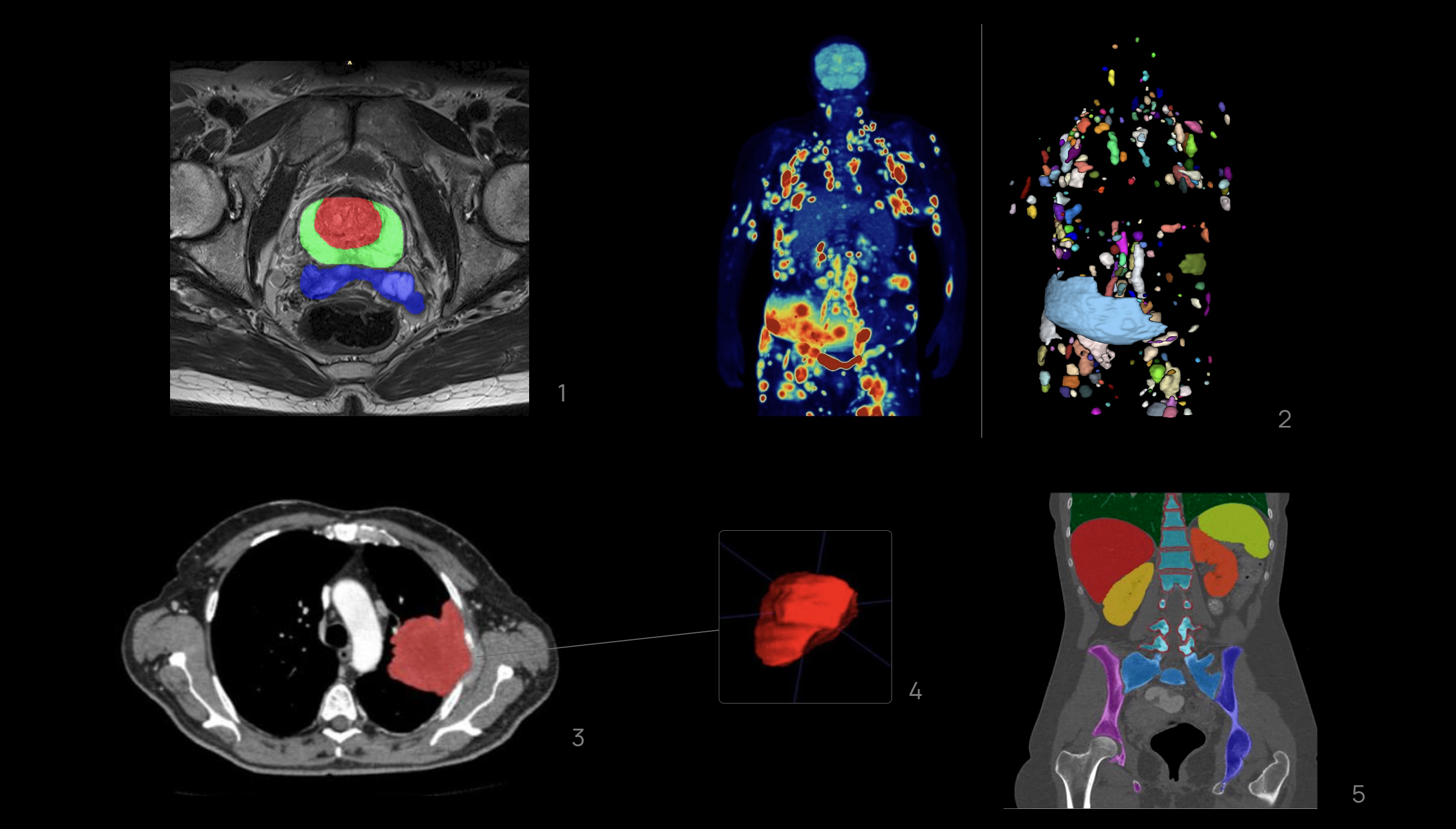 medical imaging