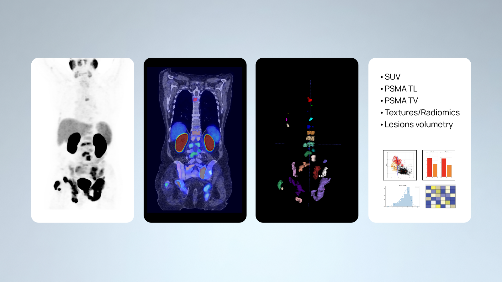 Prostate Cancer Clinical Trials