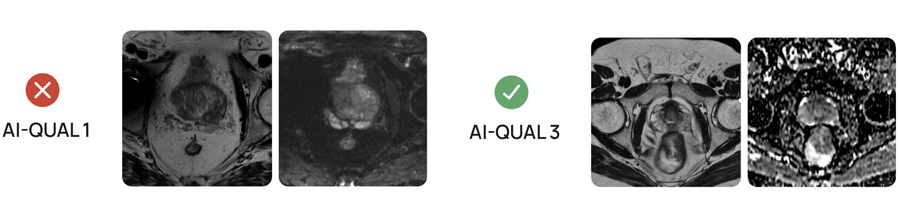 aiqual5