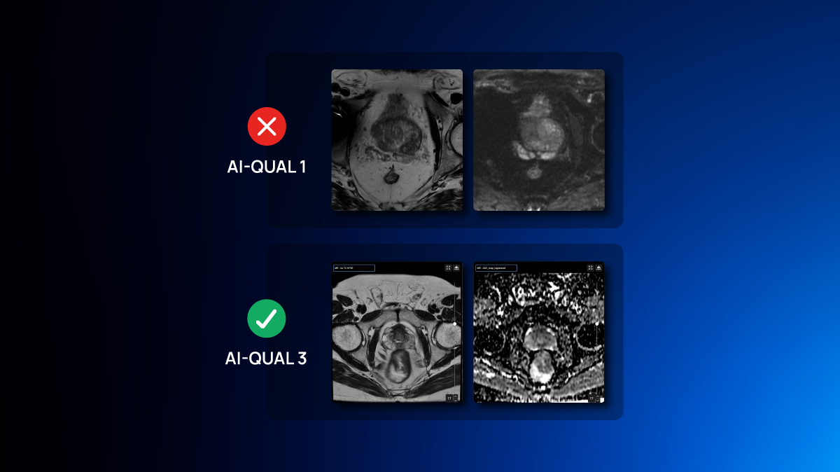 comunicado de prensa AI QUAL-04