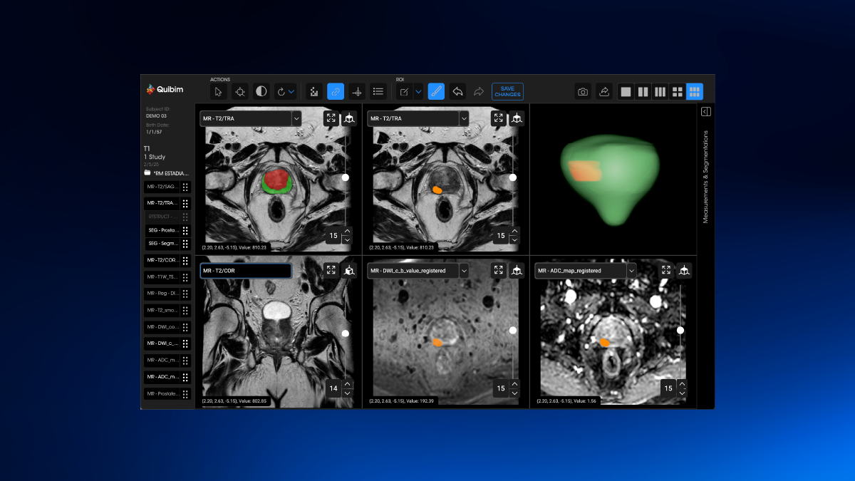 Quibim RSNA 2025 featured